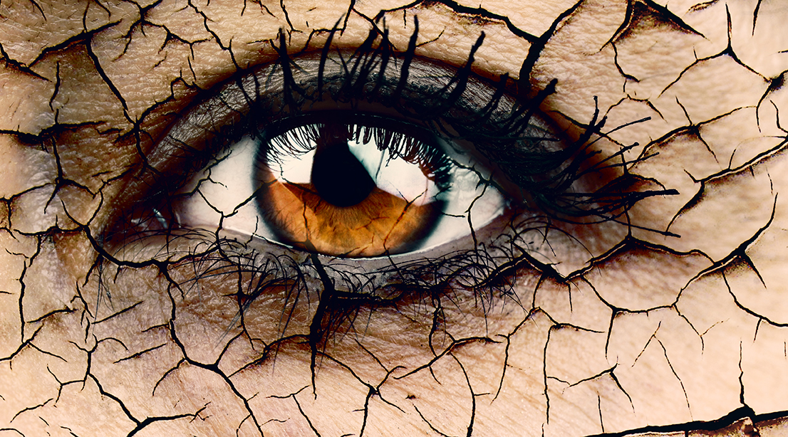 ¿Cómo prevenir el ojo seco?